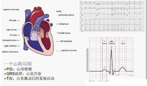 利用ECG AFE简化病人监护仪设计