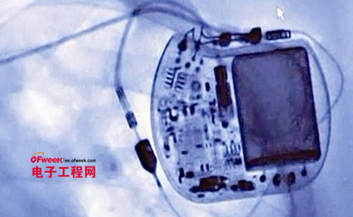植入设备:掀起你的皮肤来