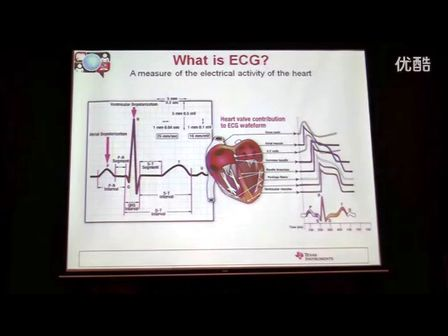心电图(ECG)信号链的模拟基础(一)