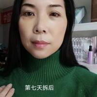 啊刘